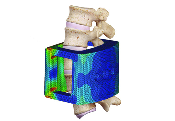 Medical and Biomedical Abaqus, Ansys Fluent, Star-ccm+, Ls-dyna, Matlab